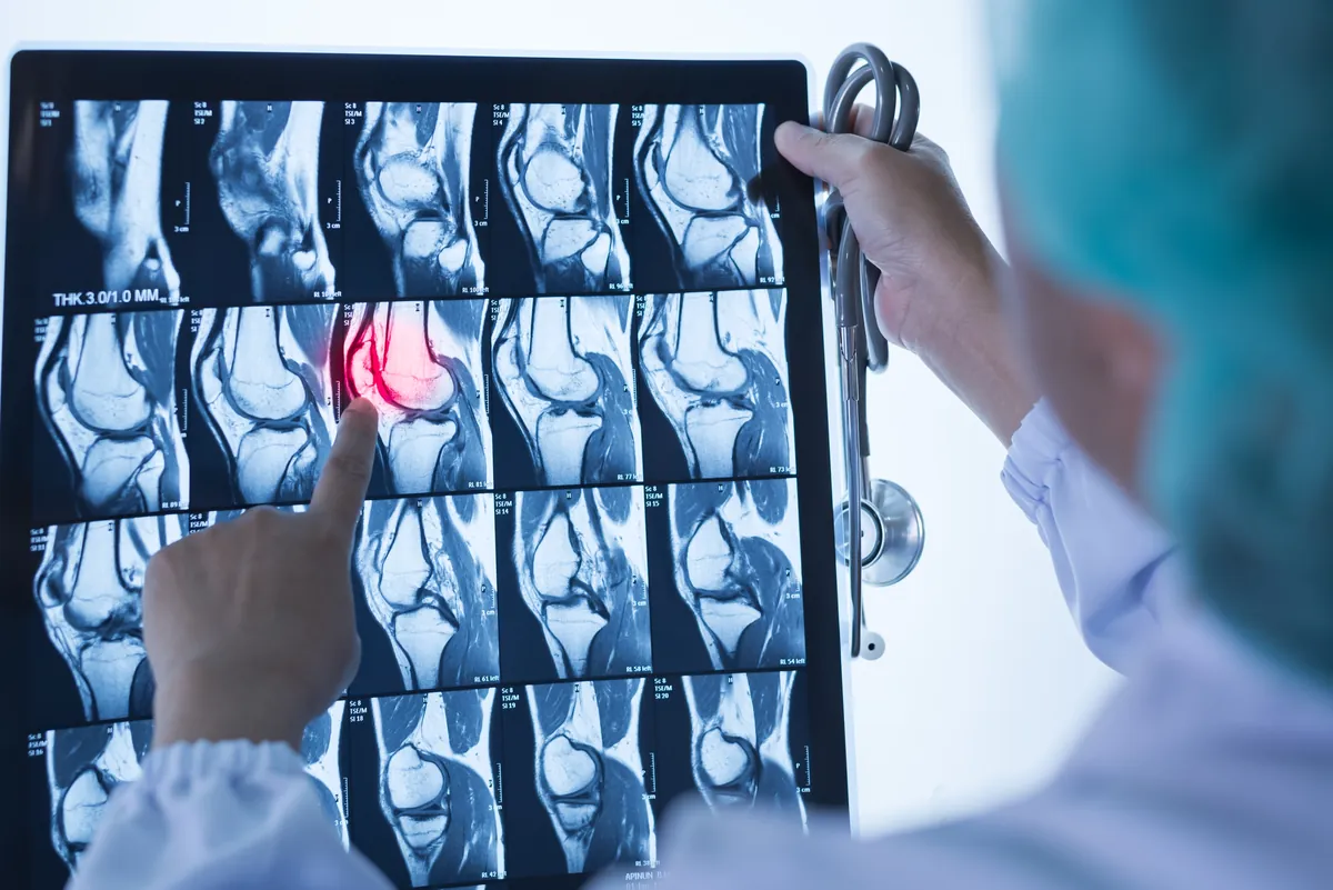 Knee MRI review