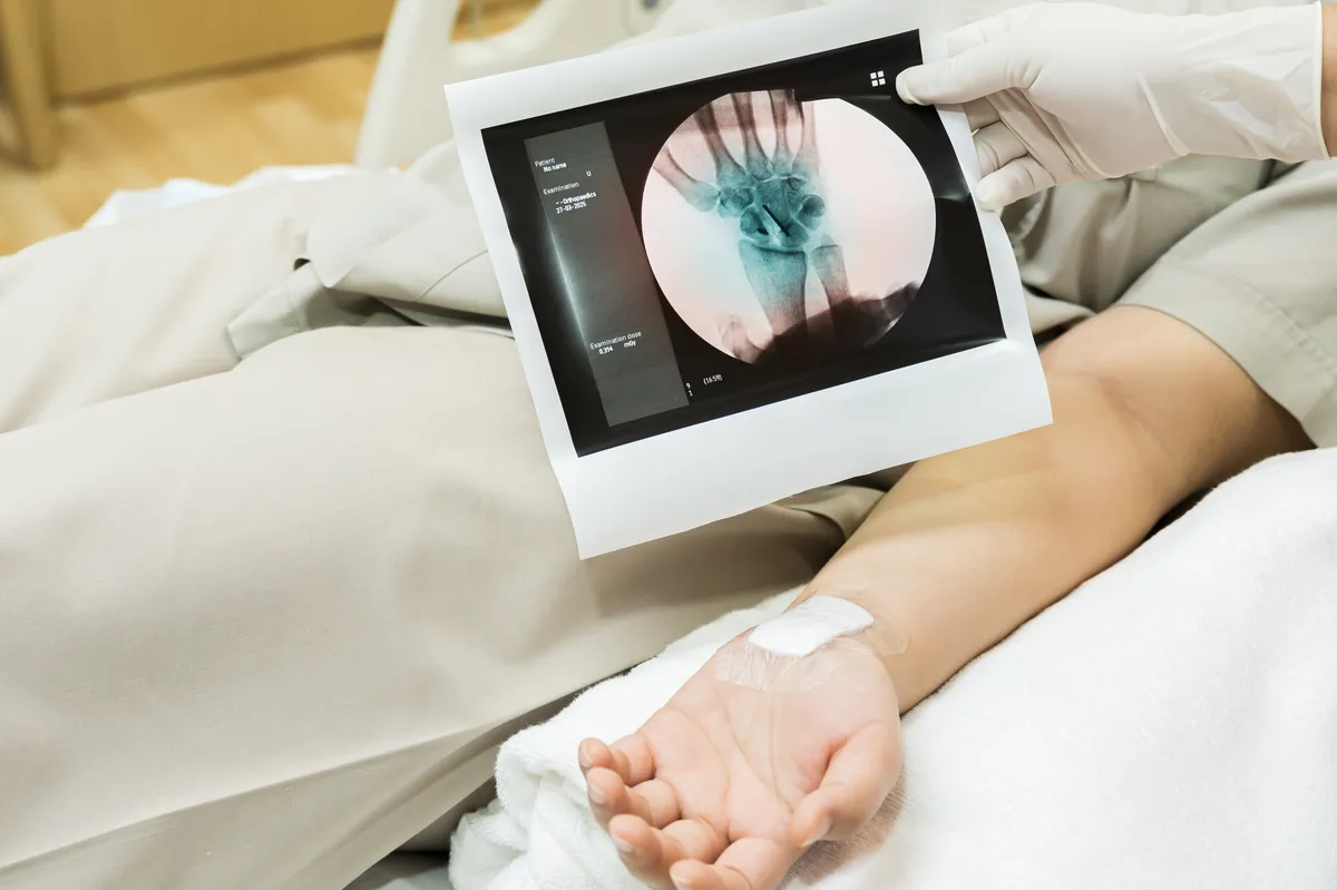 Wrist X-ray review