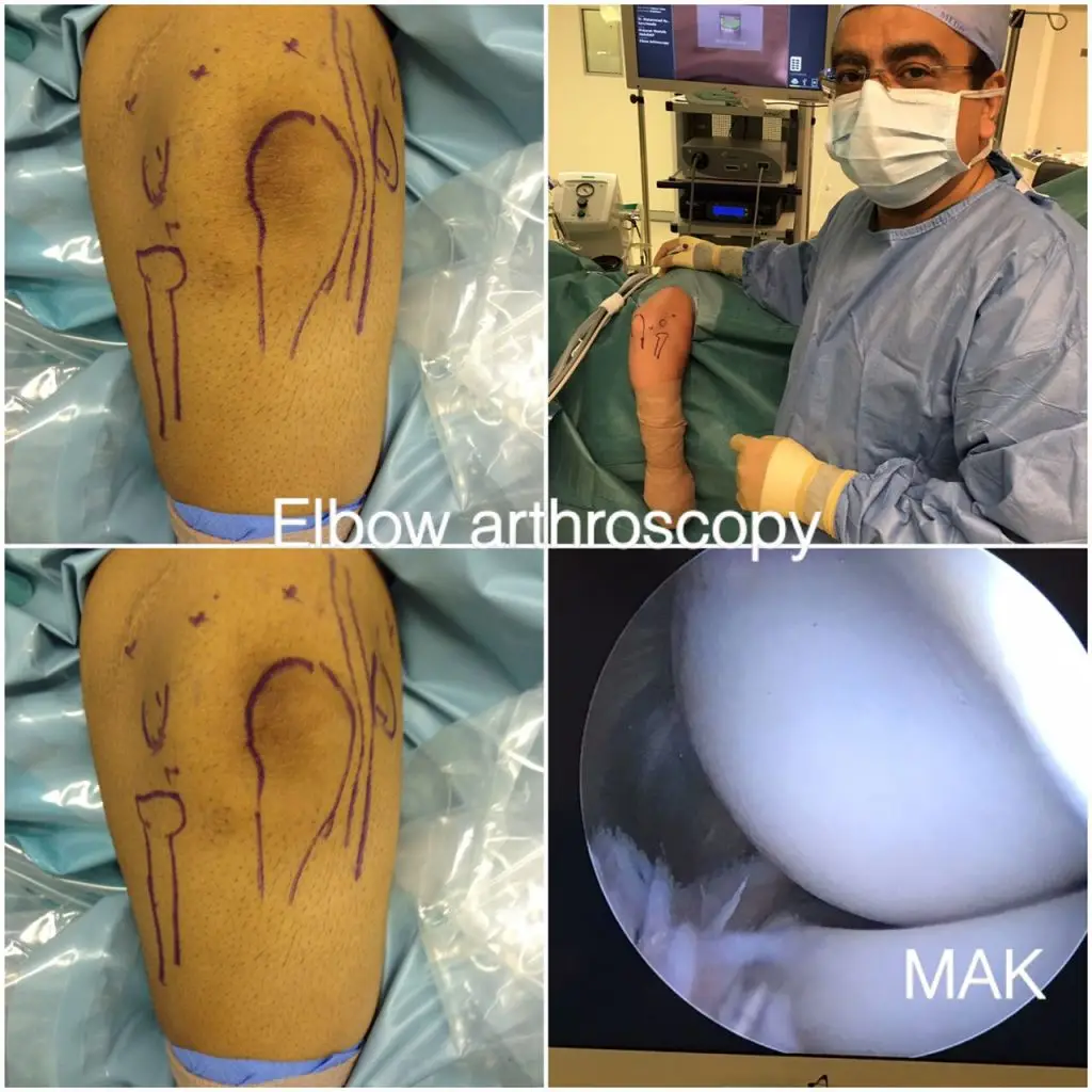 Best Orthopaedic & Sports Surgeon | Dr. Mohammad Ashfaq Konchwalla
